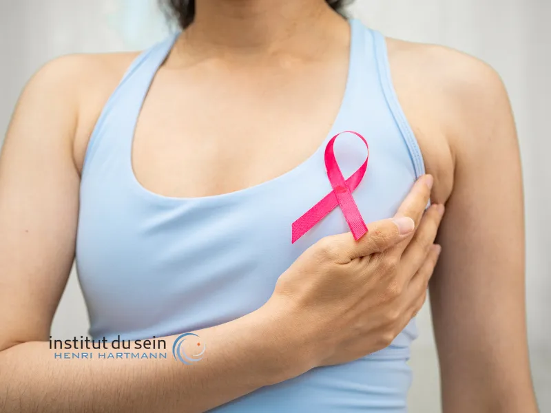 cancer du sein stade 1
